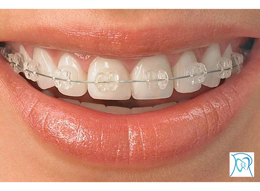 Aparelhos Esteticos